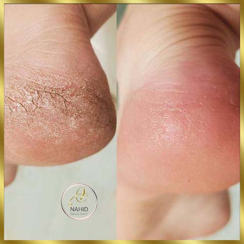 گالری پدیکور